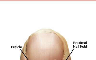 The Cuticle – Should You Clip, Push, or Scrape?