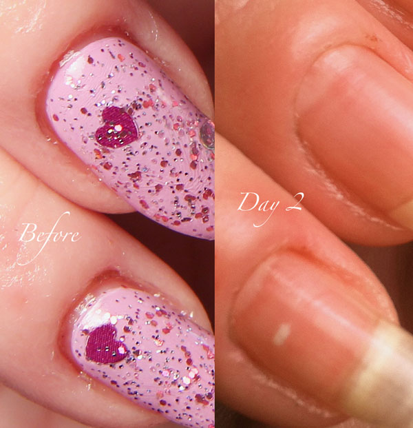 Cuticle-Before-and-Day-2-Close