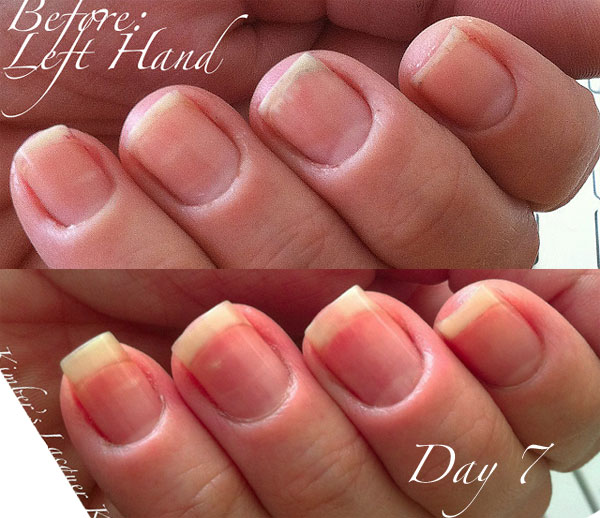 www.NailCareHQ.com Cuticle_Right-Hand-day 7 Kimber