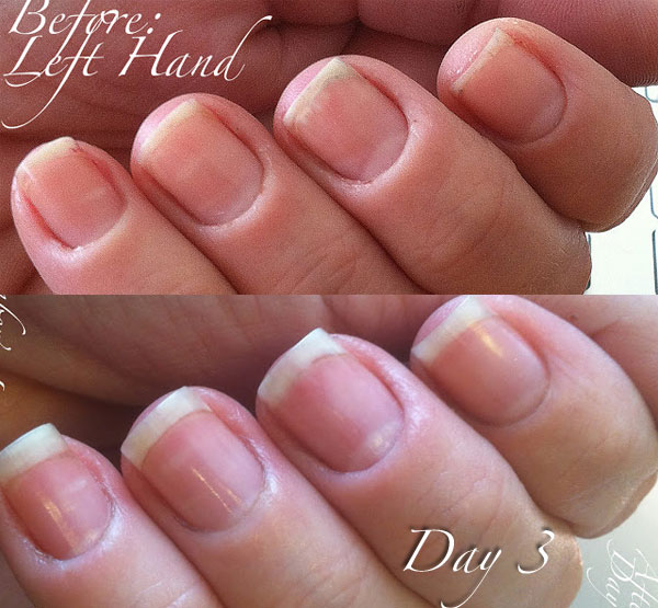 www.NailCareHQ.com Cuticle_Right-Hand-day 3 Kimber