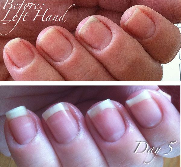 www.NailCareHQ.com Cuticle_Right-Hand-day 5 Kimber