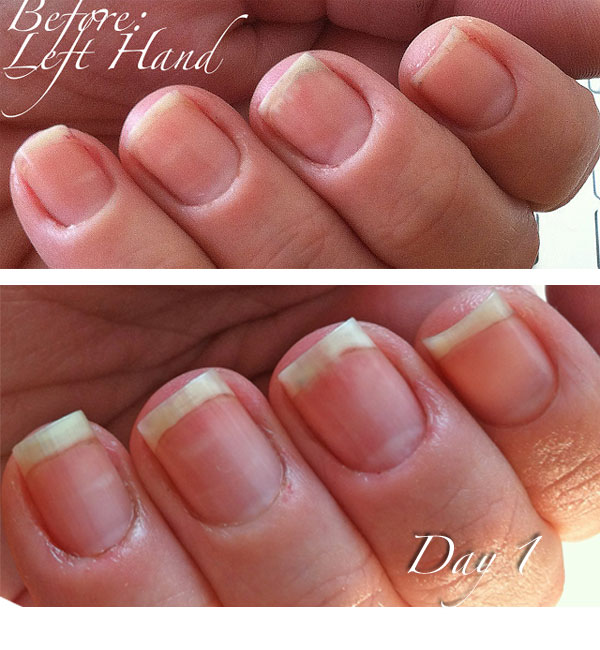 www.NailCareHQ.com Cuticle_Right-Hand-day 1 Kimber