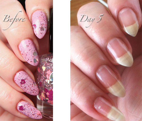 Cuticle_Right-Hand-day-5 Kimber