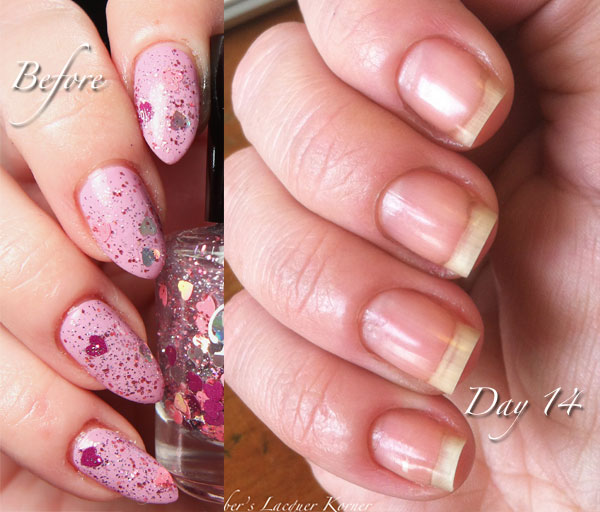 Cuticle_Right-Hand_Day14 Kimber