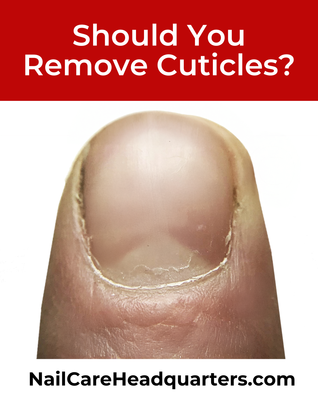 Article Title Image about if Should you remove cuticles nailcarehq