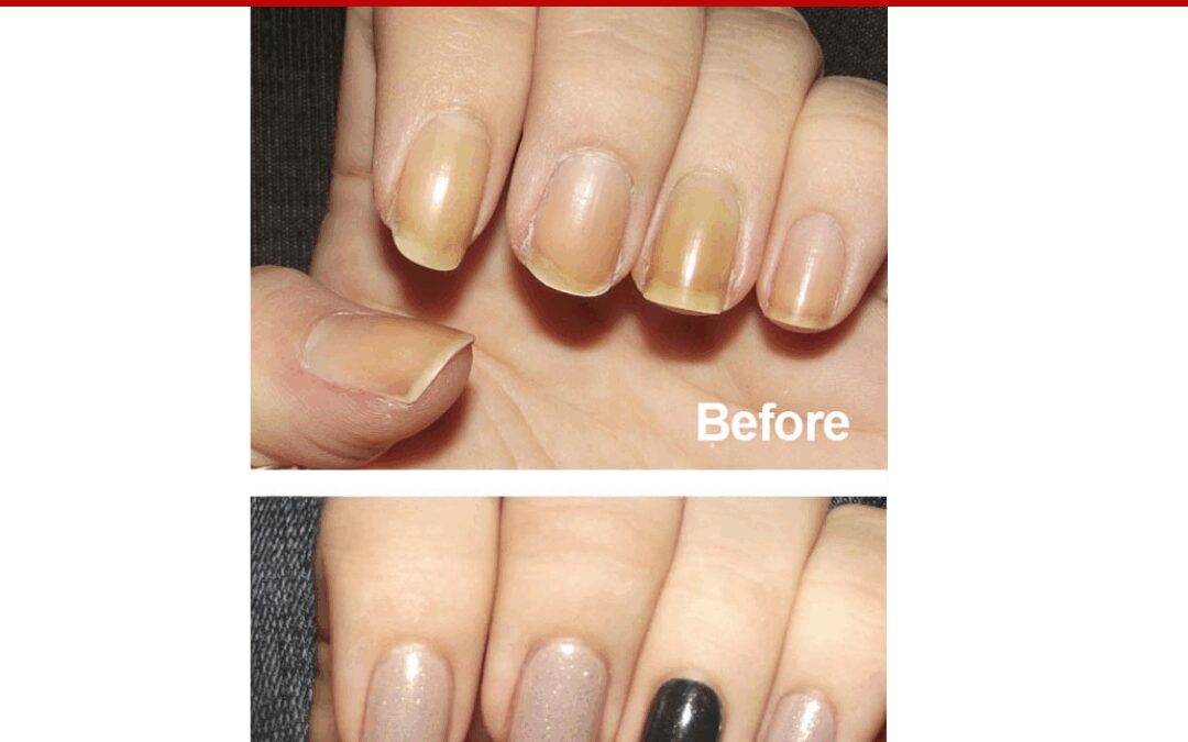STRONGER NAILS – Pure Nail Oil™ Challenger Kelli’s Results