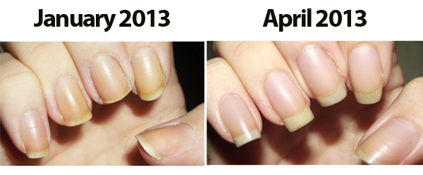 Stronger Nails Kelly before after