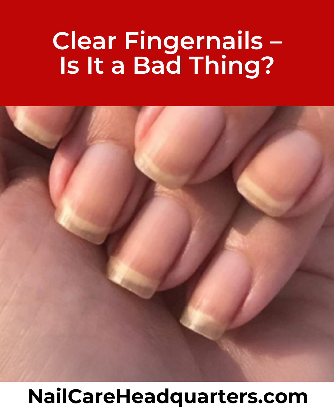 Clear Fingernails?
